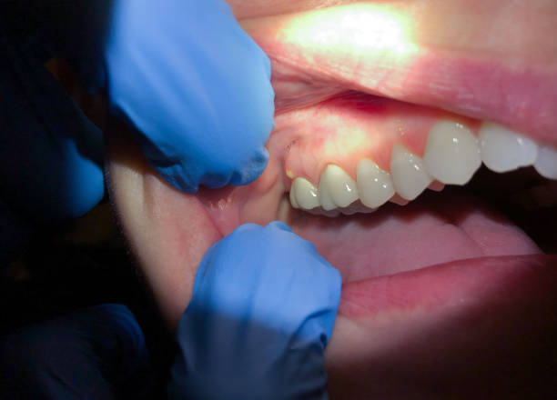 Best Emergency Treatment for Jaw Pain or Injury in Desert View Highlands, CA