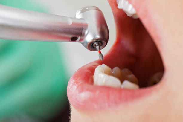 Best Emergency Root Canal Therapy in Desert View Highlands, CA